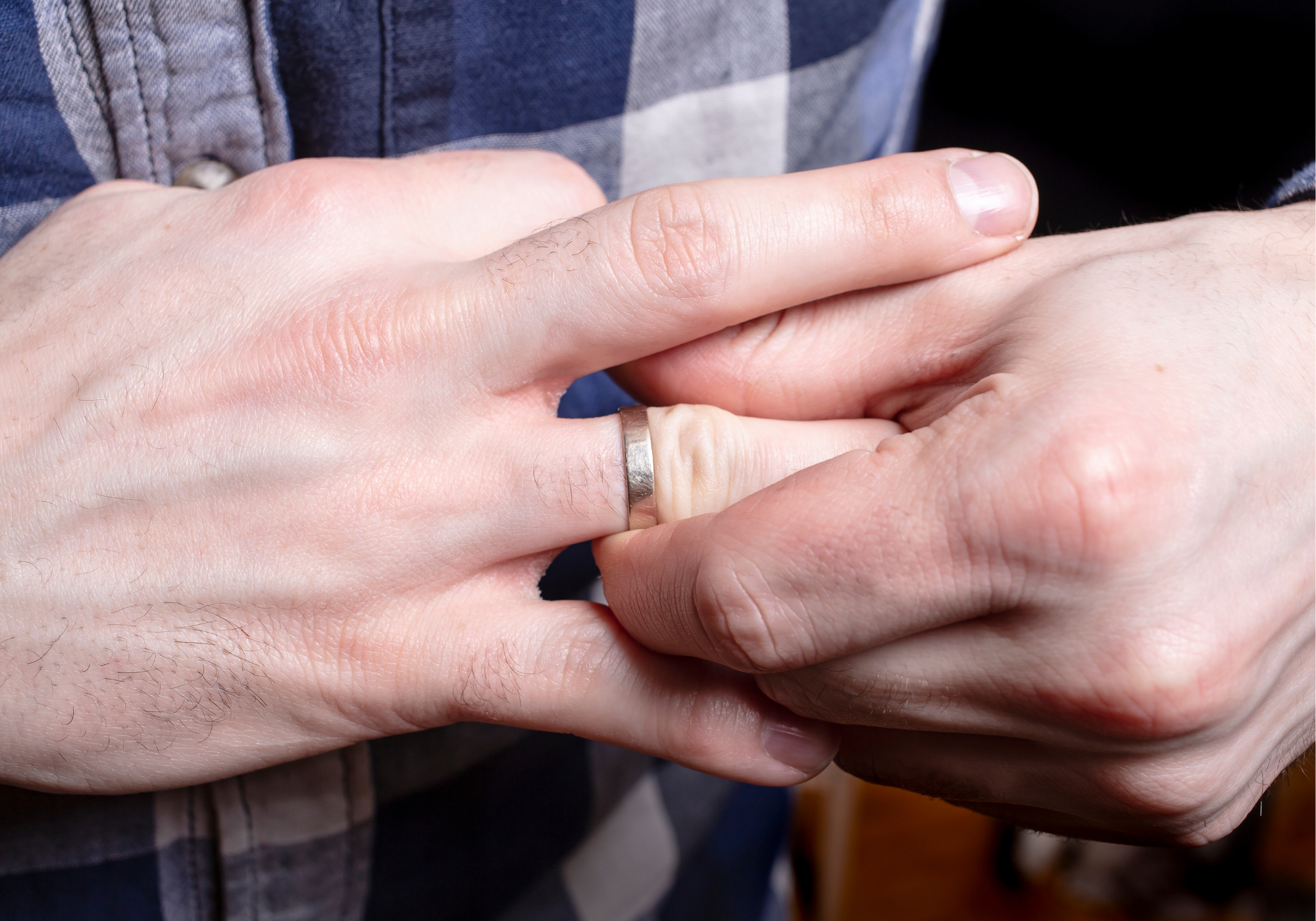 Professional Ring Removal